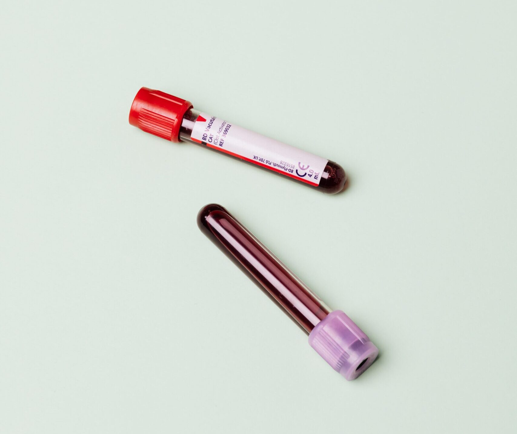 Test d’intolérance au lactose Le test sanguin AFDIAL